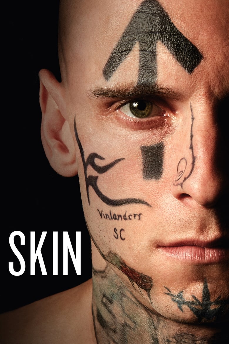 فيلم Skin
